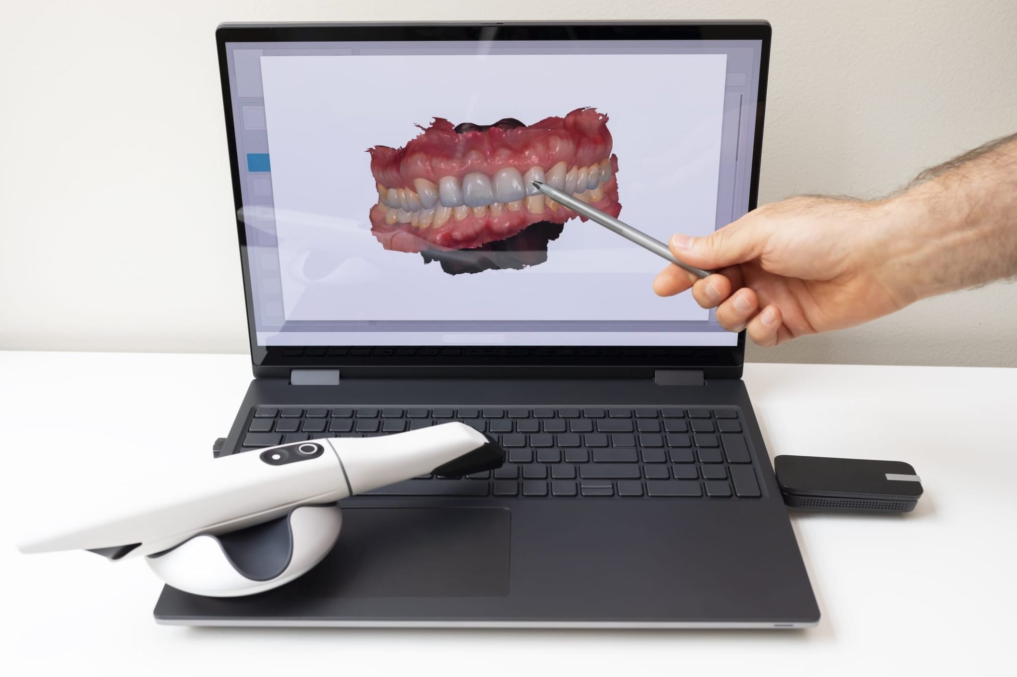 thumbnail image 2 of Unbranded Dental Intraoral 3D Scanner – CAD/CAM Digital USB Impression System 2 of 6