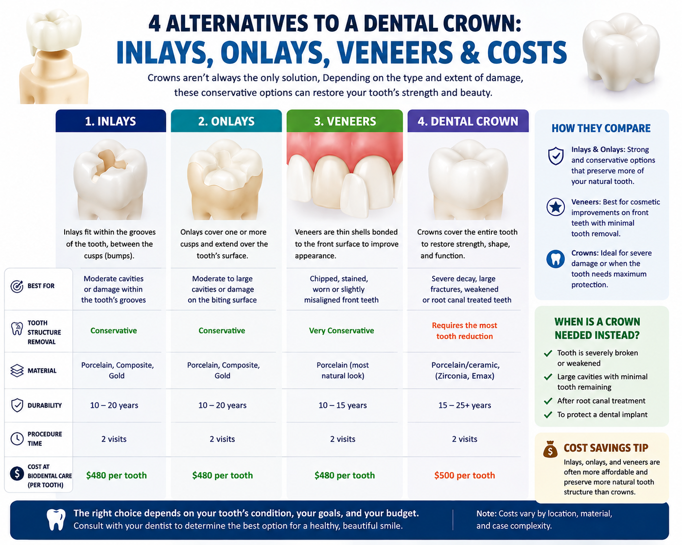 Alternatives to a Dental Crown: Inlays, Onlays, Veneers & Costs